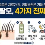 젊은 탈모 4가지 팩트체크
